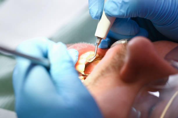 Fast & Reliable Emergency Dental Services in VT